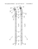 Bone Compression and Fixation Devices diagram and image