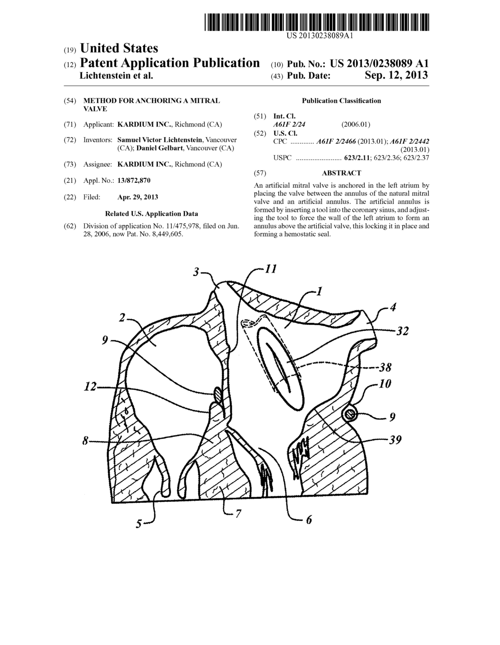 METHOD FOR ANCHORING A MITRAL VALVE - diagram, schematic, and image 01