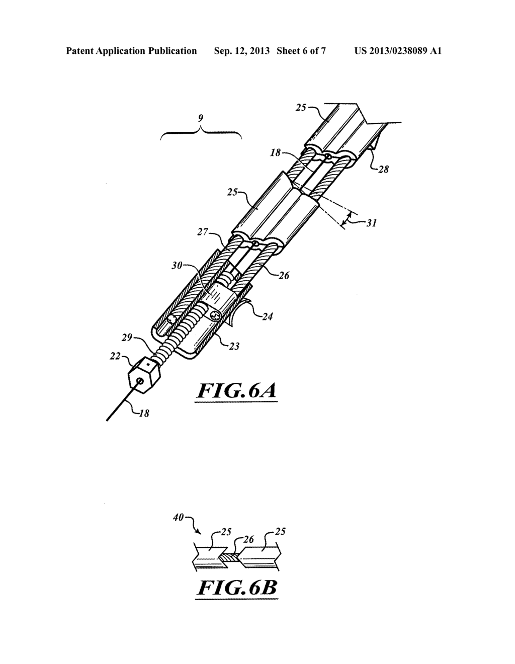 METHOD FOR ANCHORING A MITRAL VALVE - diagram, schematic, and image 07