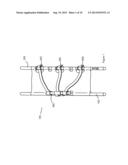 Stretcher With Improved Use Efficiency diagram and image