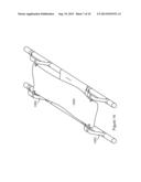 Stretcher With Improved Use Efficiency diagram and image