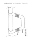 Stretcher With Improved Use Efficiency diagram and image