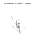 METHOD AND DEVICES FOR FRAMING OPENINGS IN CAST-IN-PLACE WALLS diagram and image