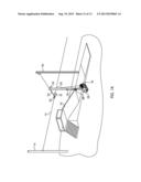 Trolley Braking System diagram and image