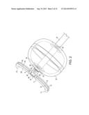 CERVICAL CERCLAGE ASSISTANCE DEVICE diagram and image