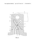 CERVICAL CERCLAGE ASSISTANCE DEVICE diagram and image