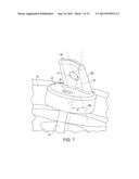 CERVICAL CERCLAGE ASSISTANCE DEVICE diagram and image