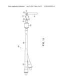 CERVICAL CERCLAGE ASSISTANCE DEVICE diagram and image