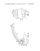 CERVICAL CERCLAGE ASSISTANCE DEVICE diagram and image