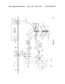 AUTOMATED THERMAL EXCHANGE SYSTEM diagram and image