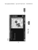 SHOWING SKIN LESION INFORMATION diagram and image