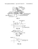 EARHEALTH MONITORING SYSTEM AND METHOD IV diagram and image