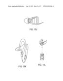 EARHEALTH MONITORING SYSTEM AND METHOD IV diagram and image