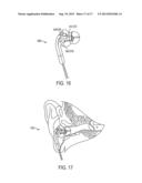 EARHEALTH MONITORING SYSTEM AND METHOD IV diagram and image