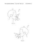 SELECTIVE ADAPTIVE AUDIO CANCELLATION ALGORITHM CONFIGURATION diagram and image