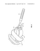 BATTERY MODULE FOR PERPENDICULAR DOCKING INTO A CANAL HEARING DEVICE diagram and image