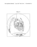 IMAGE-PROCESSING APPARATUS AND X-RAY DIAGNOSTIC APPARATUS diagram and image