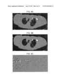 METHOD AND SYSTEM UTILIZING PARAMETER-LESS FILTER FOR SUBSTANTIALLY     REDUCING STREAK AND OR NOISE IN COMPUTER TOMOGRAPHY (CT) IMAGES diagram and image