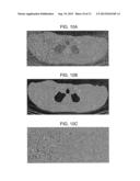 METHOD AND SYSTEM UTILIZING PARAMETER-LESS FILTER FOR SUBSTANTIALLY     REDUCING STREAK AND OR NOISE IN COMPUTER TOMOGRAPHY (CT) IMAGES diagram and image