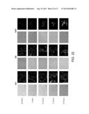 MULTI-COMPARTMENTAL MACROPHAGE DELIVERY diagram and image