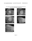 FOAMABLE FORMULATION diagram and image