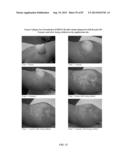 FOAMABLE FORMULATION diagram and image