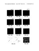 COMPOSITIONS AND METHODS FOR REGULATING ANGIOGENESIS diagram and image