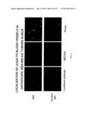Methods for Treating Diseases and HSV Using Antibodies to     Aminophospholipids diagram and image
