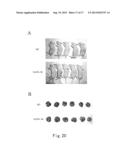 METHOD FOR CANCER DETECTION diagram and image