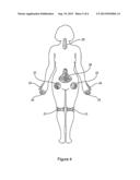 Drug Depots Having Different Release Profiles for Reducing, Preventing or     Treating Pain and Inflammation diagram and image