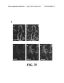 MICELLE COMPOSITIONS AND METHODS FOR THEIR USE diagram and image