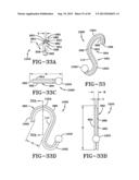 Rod or Wire Having Discontinous Cross Sections, and Implements Made from     Such Rod or Wire diagram and image