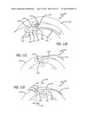 [[Multi-Ply]] Strap guide system and methods thereof for robotic surgical     arms Drive Trains for Robotic Arms diagram and image