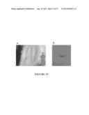 INJECTABLE CHITOSAN MIXTURES FORMING HYDROGELS diagram and image