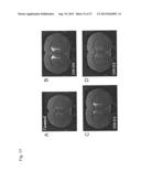 USE OF 3-METHOXY-PREGNENOLONE FOR THE PREPARATION OF A DRUG FOR TREATING     DEPRESSIVE DISORDERS AND LONG-TERM NEUROLOGICAL DISEASES diagram and image