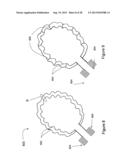 ELECTRONICS FOR DETECTION OF A CONDITION OF TISSUE diagram and image