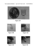 ELECTRONICS FOR DETECTION OF A CONDITION OF TISSUE diagram and image