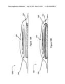 ELECTRONICS FOR DETECTION OF A CONDITION OF TISSUE diagram and image