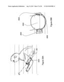 ELECTRONICS FOR DETECTION OF A CONDITION OF TISSUE diagram and image