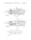 ELECTROMAGNETIC SHIELD FOR A PASSIVE ELECTRONIC COMPONENT IN AN ACTIVE     MEDICAL DEVICE IMPLANTABLE LEAD diagram and image