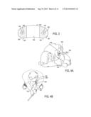 DEVICE FEATURES AND DESIGN ELEMENTS FOR LONG-TERM ADHESION diagram and image