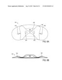 DEVICE FEATURES AND DESIGN ELEMENTS FOR LONG-TERM ADHESION diagram and image