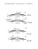 DEVICE FEATURES AND DESIGN ELEMENTS FOR LONG-TERM ADHESION diagram and image