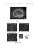 Nanoporous Metal Multiple Electrode Array and Method of Making Same diagram and image