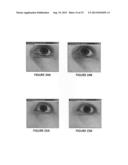 Quantification of Under-Eye Skin Color diagram and image
