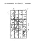 Adjustable Overlay  Patterns for Medical Display diagram and image