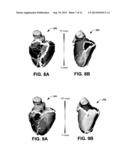 SYSTEM AND METHODS FOR ASSESSING HEART FUNCTION diagram and image