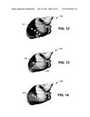 SYSTEM AND METHODS FOR ASSESSING HEART FUNCTION diagram and image