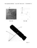 R-Wave Detection Method diagram and image