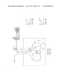 MINIMALLY INVASIVE DETERMINATION OF COLLATERAL VENTILATION IN LUNGS diagram and image